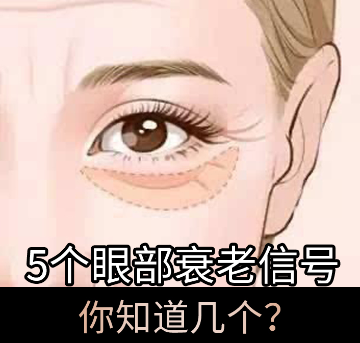 5個(gè)眼部衰老信號(hào)，你知道幾個(gè)？
