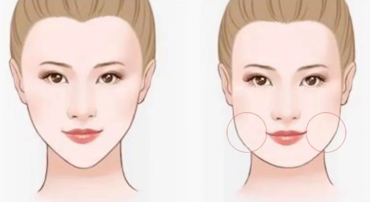 “大臉危機(jī)”，比發(fā)福更可怕的是發(fā)腮！