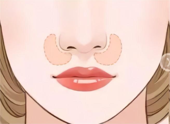 鼻基底凹陷法令紋自測｜教你如何區(qū)分