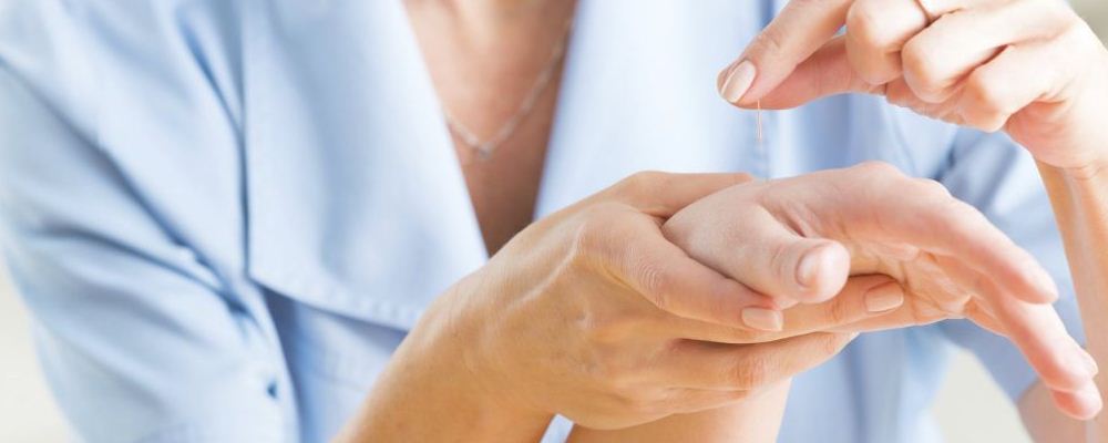 不同針灸療法的美容功效