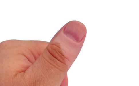 影響黑色素合成的四大類藥物