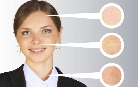 如何做好美白 讓黑色素?zé)o可遁形