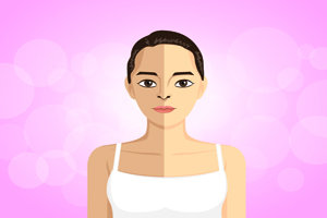 身上長(zhǎng)痘痘怎么辦