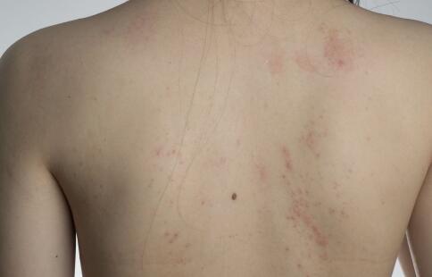 如何徹底消滅皺紋色斑？