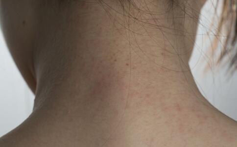 如何徹底消滅皺紋色斑？[3]