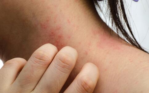 自制水果面膜防皺消除皺紋