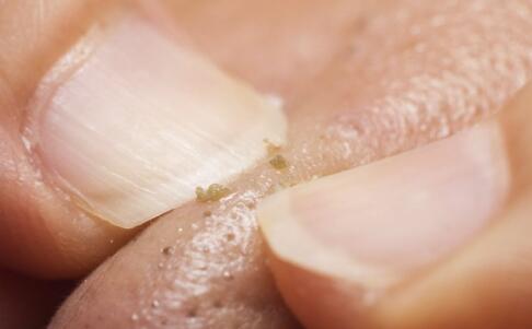 奔三女人的防皺去皺方法