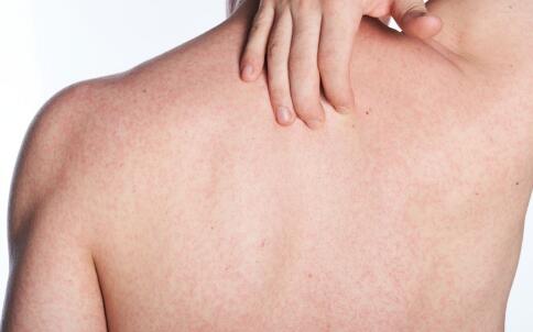 秋季 別讓皺紋有機可乘